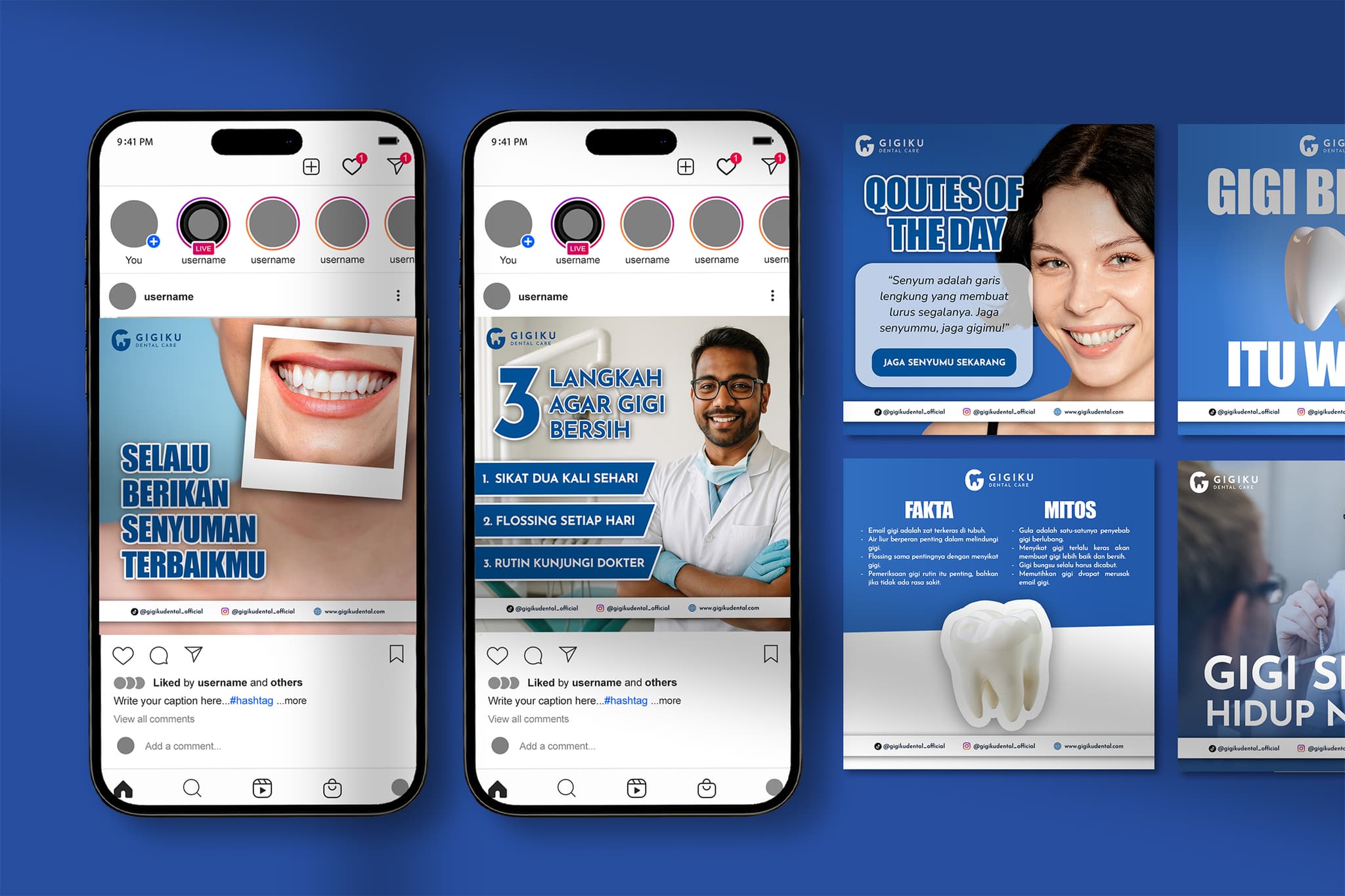 image number 0 of this project